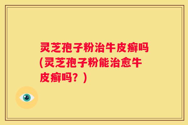 灵芝孢子粉牛皮癣吗(灵芝孢子粉能愈牛皮癣吗？)